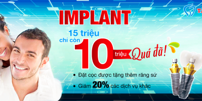 Implant cao cấp 15 triệu chỉ còn 10 triệu