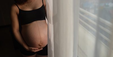 Mách Bạn 2 Cách Trị Rạn Da Sau Sinh Bằng Bã Cà Phê Siêu Đơn Giản