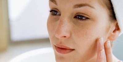 2 Nguyên Tắc Trị Nám Thành Công Bạn Nhất Định Phải Nắm Rõ