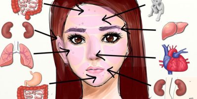 Nổi mụn ở vị trí này là dấu hiệu của điều gì ở phụ nữ