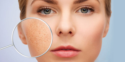 “Truy tìm” kem trị sẹo rỗ tốt nhất hiện nay được hàng triệu người công nhận