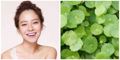 Khám phá 4 cách trị rỗ mặt bằng phương pháp tự nhiên hiệu quả tận gốc