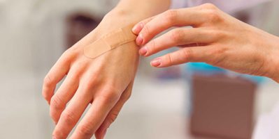 Mách bạn 5 cách liền sẹo nhanh nhất, đơn giản mà hiệu quả ngay tại nhà