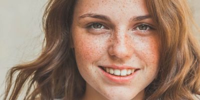 Top 7 kem trị nám tốt nhất Nhật Bản mà phái nữ “đáng sở hữu” năm 2019