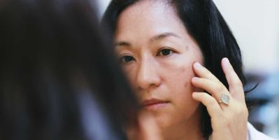 Tôi lấy lại làn da trắng mịn cùng với cách thanh lọc thải độc da rẻ tiền