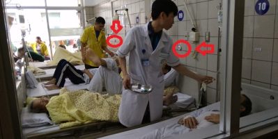 Khoa tiêu hoá bệnh viện Bạch Mai đưa hệ thống chuông gọi y tá vào hoạt động