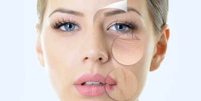 Nâng cơ, trẻ hóa làn da với công nghệ Thermagic Lift