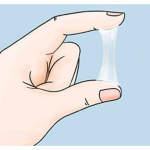 Tiết dịch âm đạo nhiều có phải là triệu chứng của ung thư cổ tử cung?