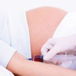 Xét nghiệm sàng lọc dị tật trước sinh là gì ?