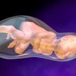 Những bất thường về màu sắc nước ối mẹ bầu cần biết