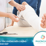 Tìm hiểu về các phương pháp bó bột xương hiện nay
