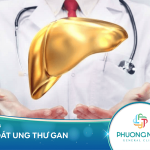 Một số phương pháp xét nghiệm ung thư gan