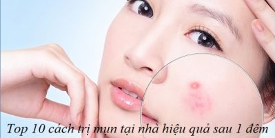 6 Loại kem trị mụn và chống lão hóa hiệu quả , được nhiều người sử dụng