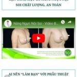 Nâng ngực có sữa cho con bú không?