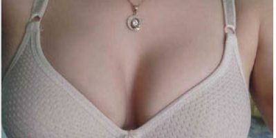 Nâng ngực chảy xệ có nguy hiểm không? Tamsudaokeo