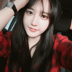 Thẩm mỹ viện Ngô Mộng Hùng nâng mũi bọc Megaderm có tốt không