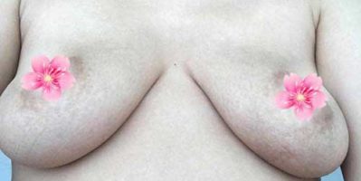 Làm sao để ngực không bị chảy xệ sau sinh? Tamsudaokeo