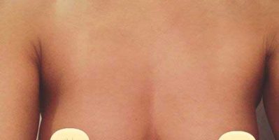 Không biết ngực xệ làm sao săn chắc – Tamsudaokeo