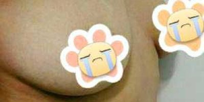 Cách khắc phục ngực chảy xệ sau sinh? Tamsudaokeo