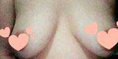 Treo ngực chảy xệ giá bao nhiêu tiền? Tamsudaokeo