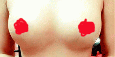 Các dấu hiệu nhận biết ngực bị chảy xệ? Tamsudaokeo