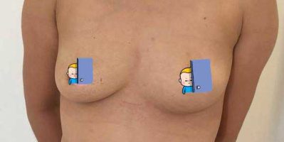 Ngực xệ tập gym có hiệu quả không? Tamsudaokeo