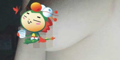 Một bên ngực bị xệ thì phải làm sao? Tamsudaokeo