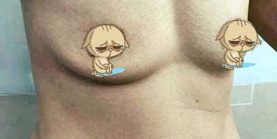 Ngực chảy xệ làm sao khắc phục? Tamsudaokeo