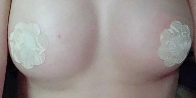 Sau khi nâng ngực bao lâu chạy xe được? Tamsudaokeo