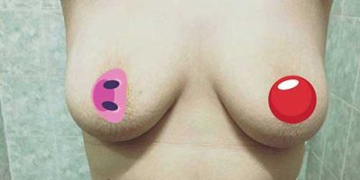 Ngực xệ mặc áo ngực như thế nào? Tamsudaokeo