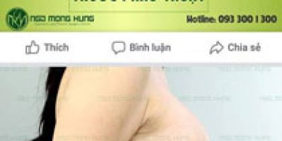 Cách chữa ngực chảy xệ sau sinh an toàn – Tamsudaokeo