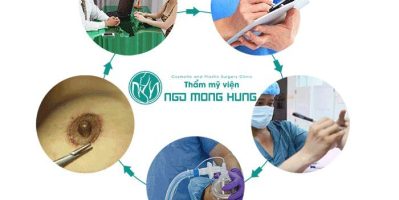 Cách cải thiện ngực chảy xệ tốt nhất hiện nay