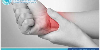 Đau nhức bắp tay là biểu hiện của bệnh gì? Liệu có nguy hiểm không?