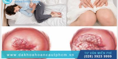 Viêm Cổ Tử Cung Nặng Có Chữa Khỏi Không?