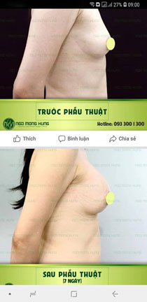Ảnh 1