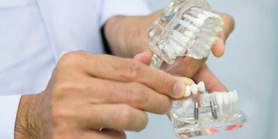 Xem các vai trò của răng hàm ?