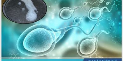 Tinh trùng có hạt như thạch rất nguy hiểm đừng xem thường