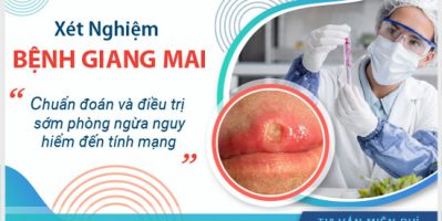 Xét nghiệm bệnh giang mai hết bao nhiêu tiền và địa chỉ khám uy tín