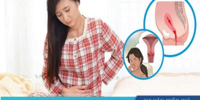 Sản dịch có mùi hôi là biểu hiện bình thường hay bất thường ? có nguy hiểm gì không ?