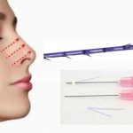 Nâng mũi bằng chỉ hàn quốc ở đâu đẹp