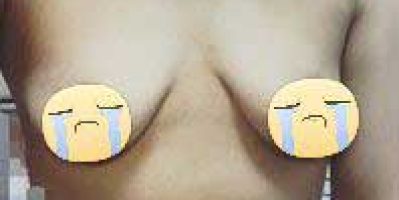 Giải đáp: Tập ngực bị xệ có hiệu quả hay không?