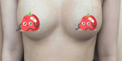 Bài tập cho ngực bị chảy xệ có thật sự hiệu quả?