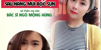 Xem video clip phẫu thuật nâng mũi