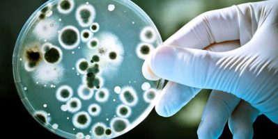 Xét nghiệm bệnh lậu bằng cách nào ?