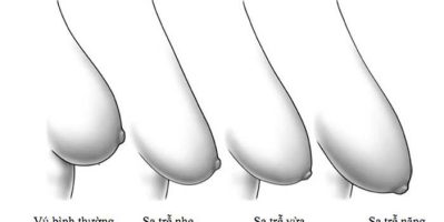 Bí quyết làm sao để ngực săn chắc và không chảy xệ