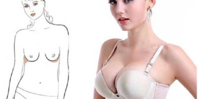 Điều trị chảy xệ bằng cách chống ngực chảy xệ sau sinh