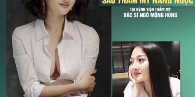 Thẩm mỹ viện chuyên nâng ngực uy tín