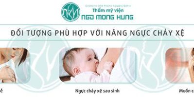 Phương pháp nâng ngực chảy xệ nào hiệu quả nhất