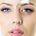Sụp mí mắt là gì? Nguyên nhân và cách khắc phục