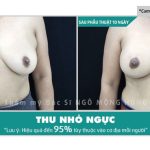 Bài tập làm ngực nhỏ lại không tốn thời gian?